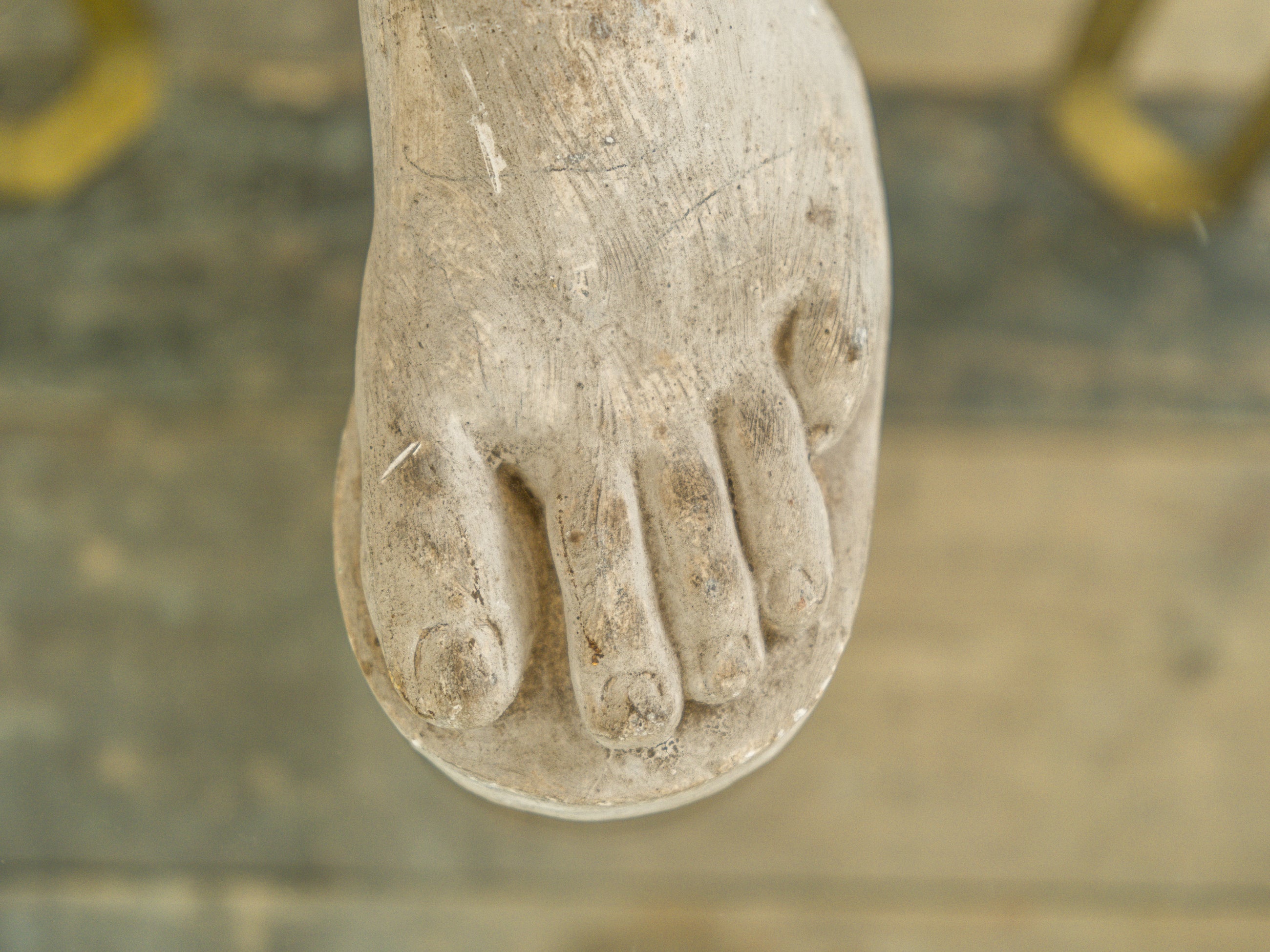 A Plaster Foot
