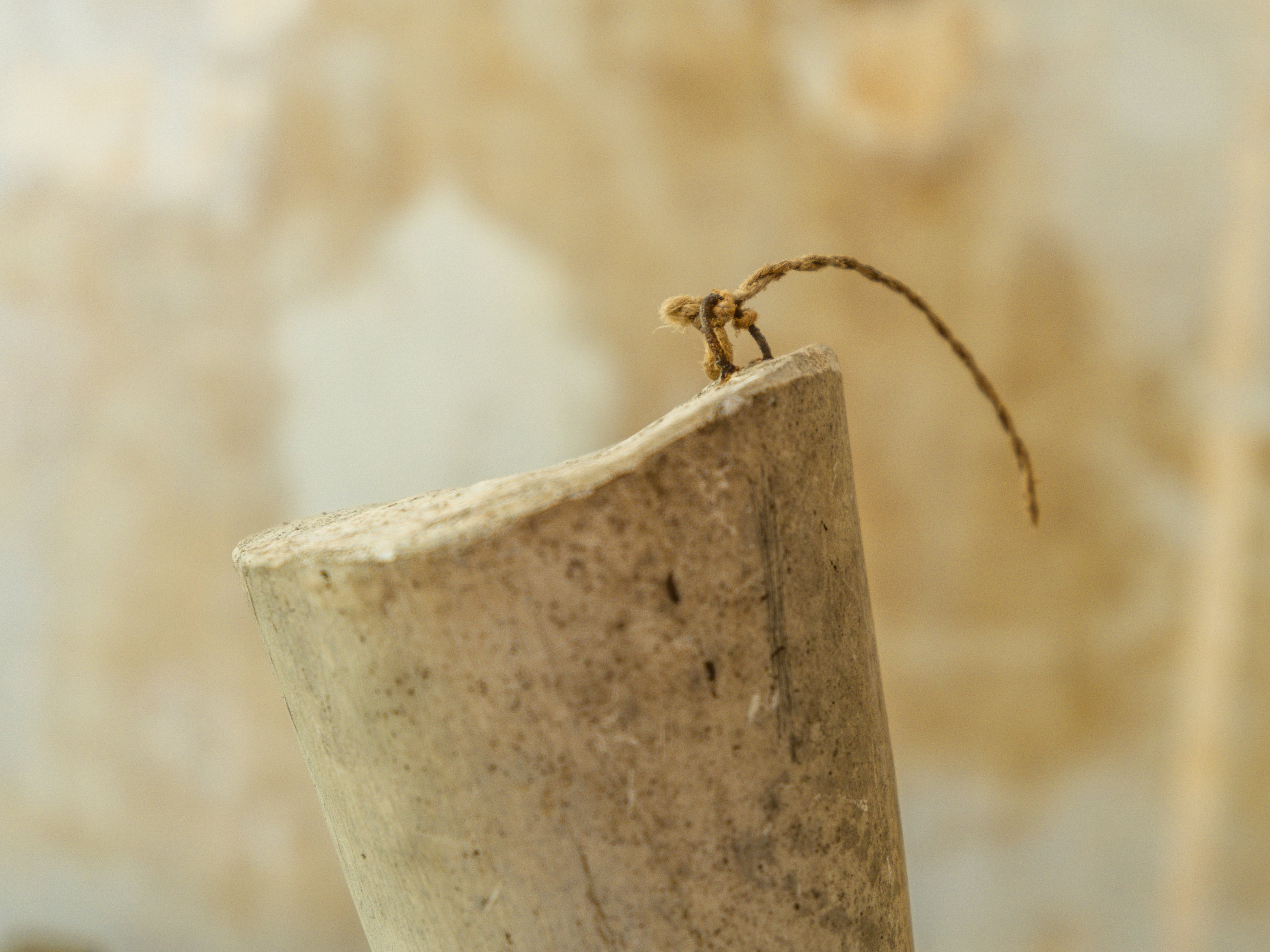A Plaster Foot