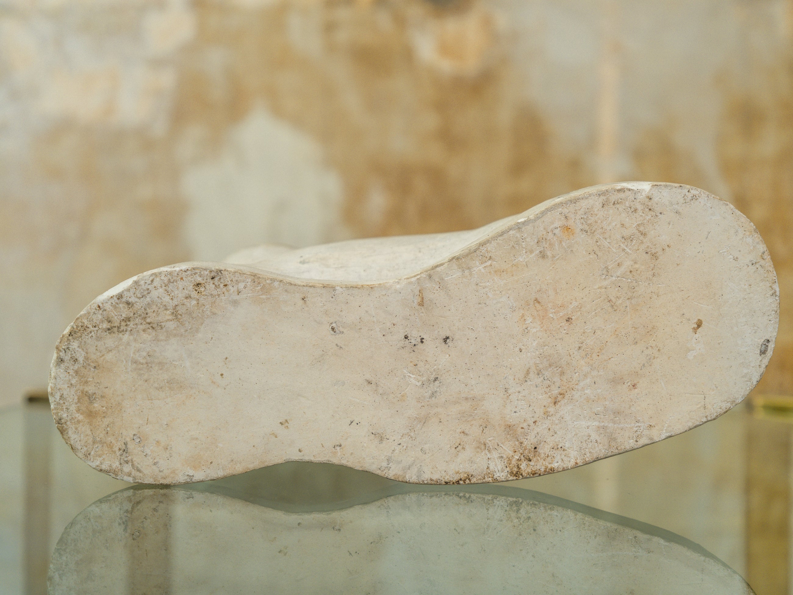 A Plaster Foot